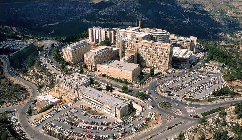 Hadassah Medical Center Gerusalemme